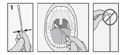Chlamydia trachomatis + N. gonorrhoeae - tampon orofaringian - Synevo
